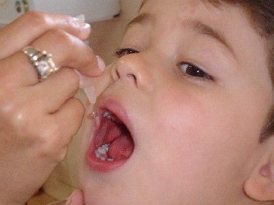 Campanha de vacinação contra a poliomielite.