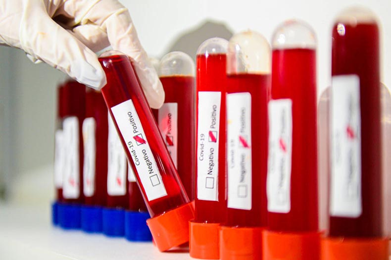 Pandemia da covid-19 está ‘longe de terminar’, diz diretor da OMS