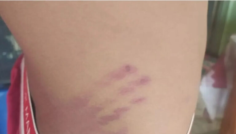 Polícia investiga caso de menino 13 anos agredido a chicotadas em Santana do Piauí; agressor filmou