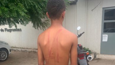Adolescente foi chicoteado na zona rural de Santana do Piauí - Foto: Divulgação