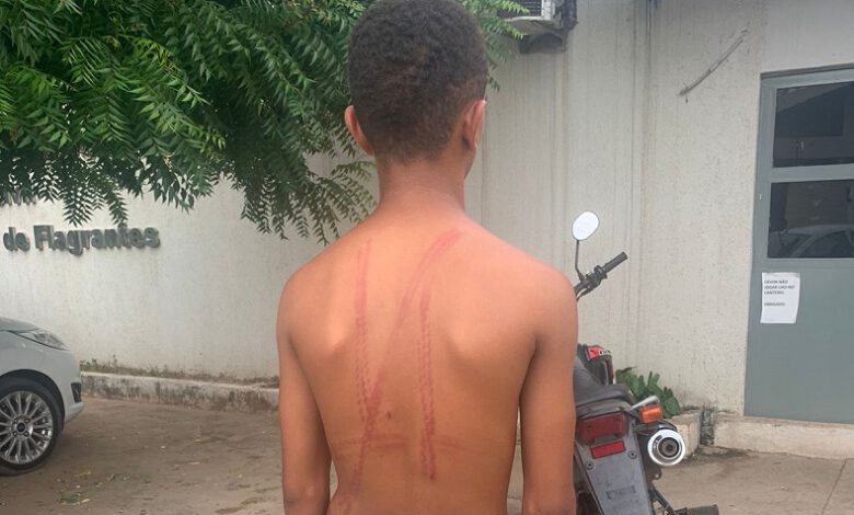 Adolescente foi chicoteado na zona rural de Santana do Piauí - Foto: Divulgação