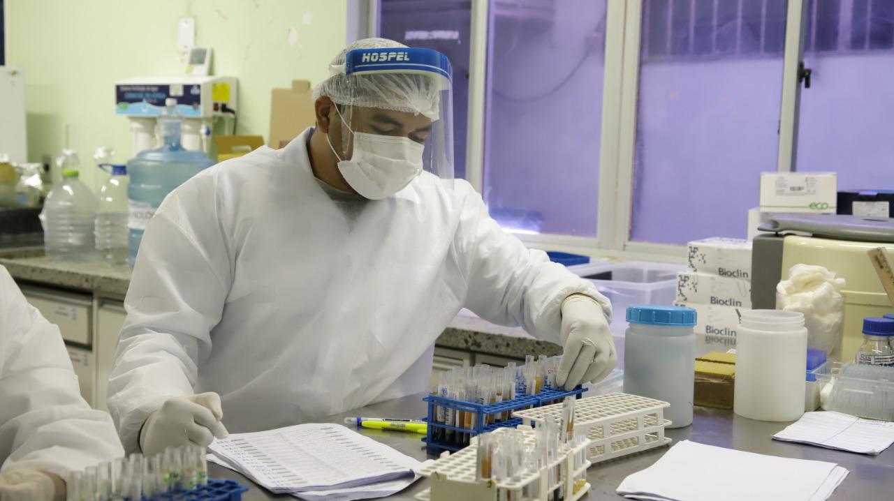 Lacen implanta novo método que detecta tuberculose em pessoas sem sintomas