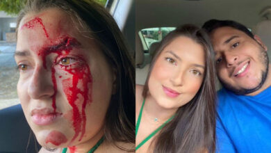 Estudante de Direito denuncia que foi agredida por namorado em Teresina - Reprodução