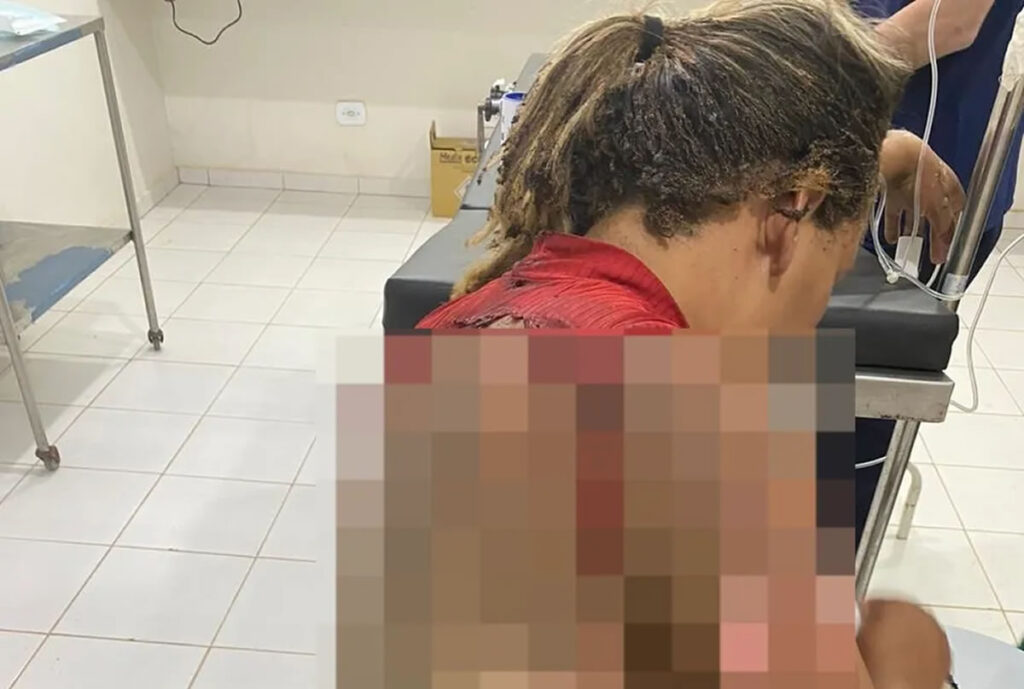 Homem é preso suspeito de atear fogo na companheira enquanto ela dormia no Piauí — Foto: Reprodução