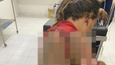 Homem é preso suspeito de atear fogo na companheira enquanto ela dormia no Piauí — Foto: Reprodução