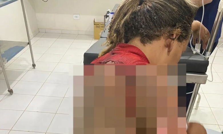 Homem é preso suspeito de atear fogo na companheira enquanto ela dormia no Piauí — Foto: Reprodução