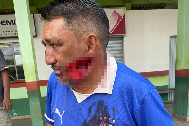 Vítima de ataque com facão em Ipiranga do Piauí não sobrevive aos ferimentos; suspeito é detido